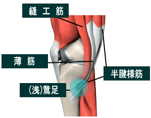 腸脛靭帯炎鵞足炎